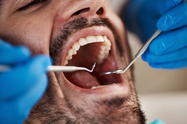 Best Knocked-Out Tooth Emergency  in La Porte City, IA
