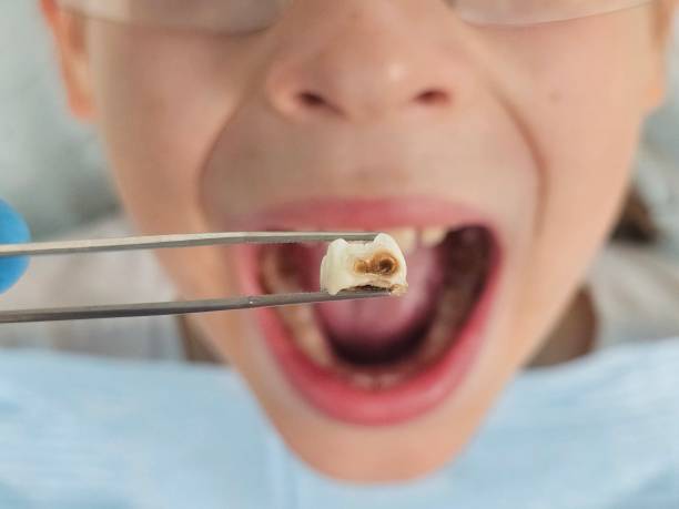 Best Cracked Tooth Emergency Dentist  in La Porte City, IA